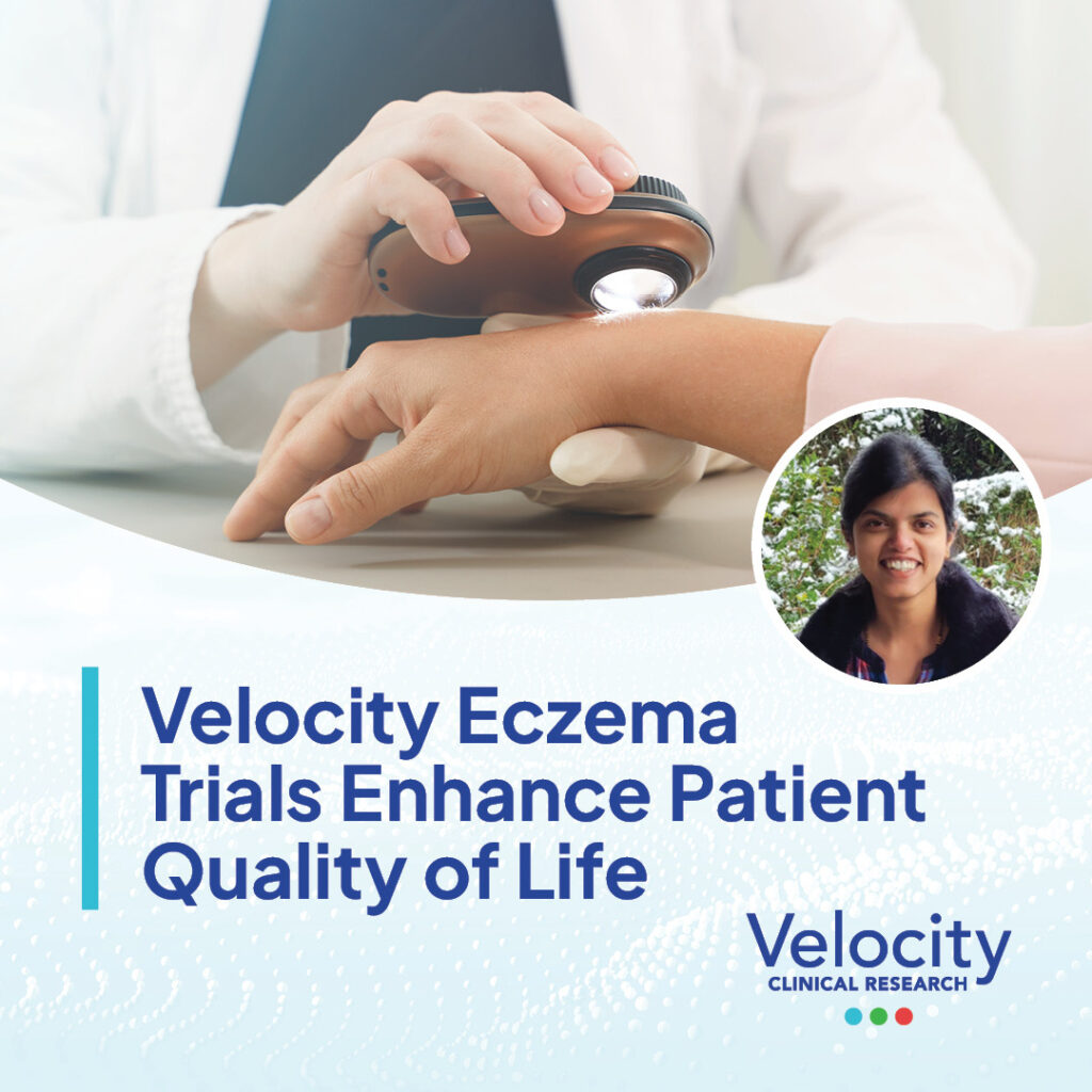 Velocity_Eczema_Trials_Enhance_Patient_Quality_of_Life